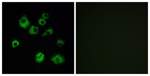 Immunofluorescence of MCF7 cells, using HCRTR1 Antibody. The picture on the right is treated with the synthesized peptide.