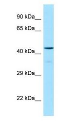 OX1R / Orexin Receptor 1 antibody Western Blot of Human brain.