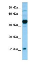OX1R / Orexin Receptor 1 antibody Western Blot of Fetal Brain.