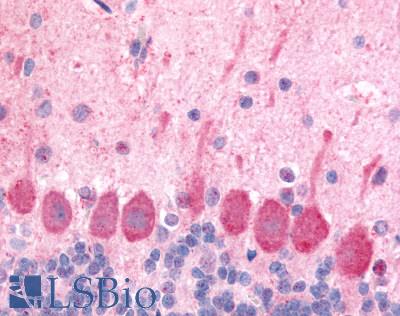 Anti-HCRTR1 / Orexin Receptor 1 antibody LS-A6638 IHC of rat brain, Purkinje neurons. Immunohistochemistry of formalin-fixed, paraffin-embedded tissue after heat-induced antigen retrieval.