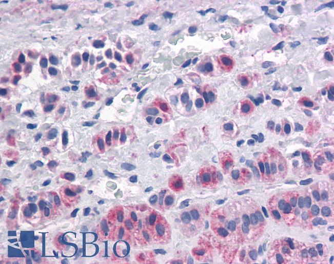 Anti-OX1R / Orexin Receptor 1 antibody IHC of human Adrenal, Pheochromocytoma. Immunohistochemistry of formalin-fixed, paraffin-embedded tissue after heat-induced antigen retrieval.