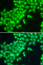 Immunofluorescence blot of MCF7 cell using METTL2A antibody. Blue: DAPI for nuclear staining.