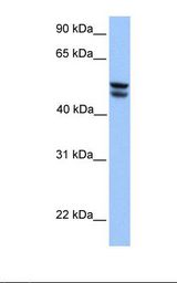 HepG2 cell lysate. Antibody concentration: 1.0 ug/ml. Gel concentration: 12%.