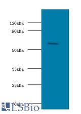 Western blot of Succinyl-CoA:3-ketoacid coenzyme A transferase 1, mitochondrial antibody at 2 ug/ml with HeLa whole cell lysate. Secondary: Goat polyclonal to Rabbit IgG at 1:15000 dilution. Predicted band size: 56 KDa. Observed band size: 56 KDa.