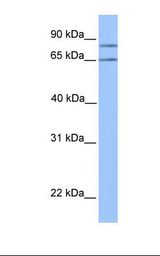 Jurkat cell lysate. Antibody concentration: 1.0 ug/ml. Gel concentration: 12%.