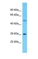 Western blot of OXCT2 Antibody with Ovary Tumor lysate.