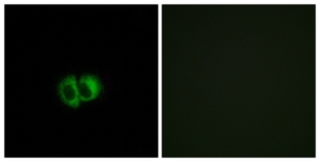 Immunofluorescence of MCF7 cells, using OXER1 Antibody. The picture on the right is treated with the synthesized peptide.