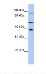 HepG2 cell lysate. Antibody concentration: 1.0 ug/ml. Gel concentration: 12%.