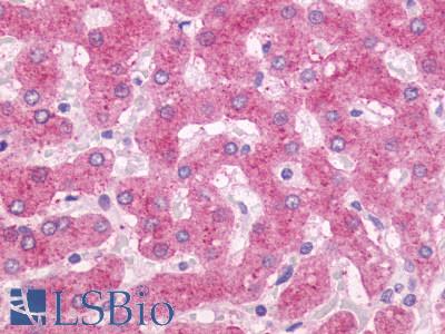 Anti-OXER1 antibody LS-A2266 IHC of human liver. Immunohistochemistry of formalin-fixed, paraffin-embedded tissue after heat-induced antigen retrieval.