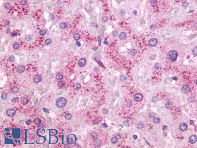 Anti-OXER1 antibody LS-A2272 IHC of human liver. Immunohistochemistry of formalin-fixed, paraffin-embedded tissue after heat-induced antigen retrieval.