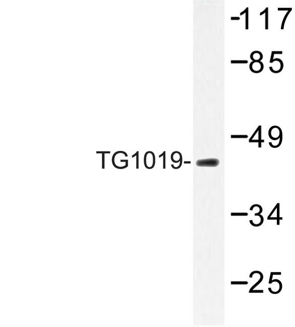 Western blot of TG1019 (R251) pAb in extracts from MCF-7 cells.