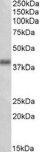 OXER1 antibody (1 ug/ml) staining of Human Lung lysate (35 ug protein/ml in RIPA buffer). Primary incubation was 1 hour. Detected by chemiluminescence.