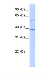 HepG2 cell lysate. Antibody concentration: 0.5 ug/ml. Gel concentration: 12%.