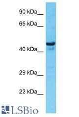 OXER1 antibody Western Blot of 786-0. Antibody dilution: 1 ug/ml.