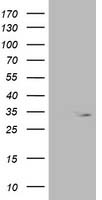 HEK293T cells were transfected with the pCMV6-ENTRY control (Left lane) or pCMV6-ENTRY OXNAD1 (Right lane) cDNA for 48 hrs and lysed. Equivalent amounts of cell lysates (5 ug per lane) were separated by SDS-PAGE and immunoblotted with anti-OXNAD1.
