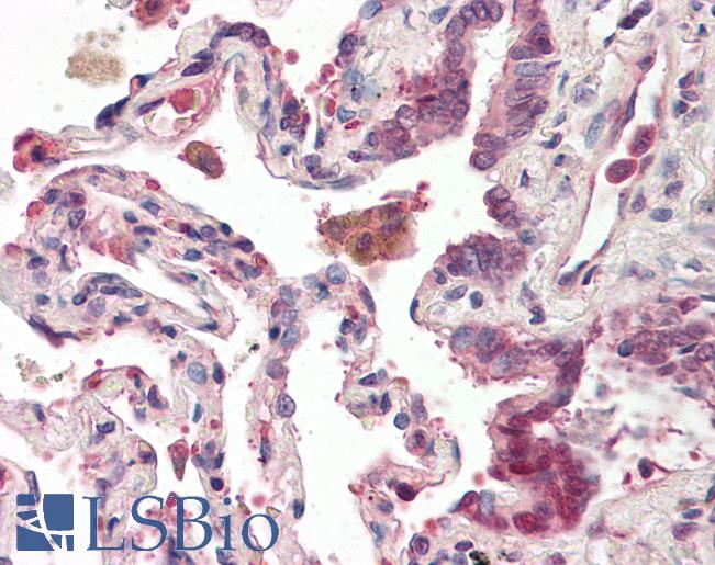 Anti-OXR1 antibody IHC of human lung. Immunohistochemistry of formalin-fixed, paraffin-embedded tissue after heat-induced antigen retrieval. Antibody LS-B8574 dilution 5 ug/ml.