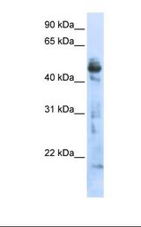 Transfected 293T cell lysate. Antibody concentration: 1.0 ug/ml. Gel concentration: 12%.