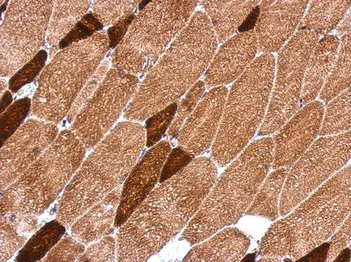 IHC of paraffin-embedded Muscle, using OXSM antibody at 1:500 dilution.