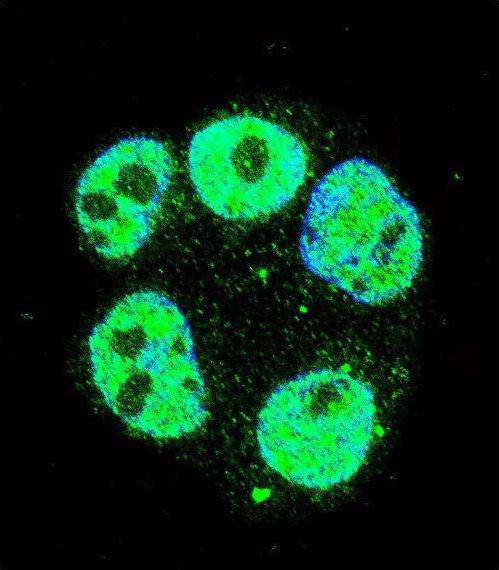 Confocal immunofluorescent of METTL2 Antibody with ZR-75-1 cell followed by Alexa Fluor 488-conjugated goat anti-rabbit lgG (green). DAPI was used to stain the cell nuclear (blue).