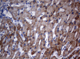 IHC of paraffin-embedded Human liver tissue using anti-OXSM mouse monoclonal antibody.