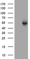 HEK293T cells were transfected with the pCMV6-ENTRY control (Left lane) or pCMV6-ENTRY OXSM (Right lane) cDNA for 48 hrs and lysed. Equivalent amounts of cell lysates (5 ug per lane) were separated by SDS-PAGE and immunoblotted with anti-OXSM.