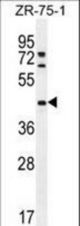 METTL2 Antibody western blot of ZR-75-1 cell line lysates (35 ug/lane). The METTL2 antibody detected the METTL2 protein (arrow).