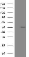 HEK293T cells were transfected with the pCMV6-ENTRY control (Left lane) or pCMV6-ENTRY MCAT (Right lane) cDNA for 48 hrs and lysed. Equivalent amounts of cell lysates (5 ug per lane) were separated by SDS-PAGE and immunoblotted with anti-MCAT.
