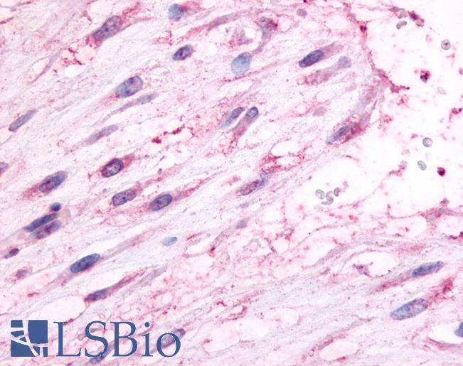 Anti-Oxytocin Receptor antibody LS-A3880 IHC of human uterus, pregnant. Immunohistochemistry of formalin-fixed, paraffin-embedded tissue after heat-induced antigen retrieval.