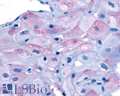 Anti-Oxytocin Receptor antibody LS-A246 IHC of human uterus, term. Immunohistochemistry of formalin-fixed, paraffin-embedded tissue after heat-induced antigen retrieval.