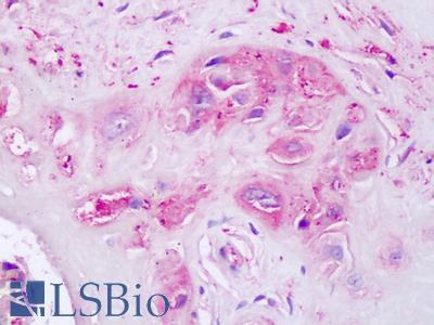 Anti-OXTR / Oxytocin Receptor antibody IHC of human placenta. Immunohistochemistry of formalin-fixed, paraffin-embedded tissue after heat-induced antigen retrieval. Antibody LS-A3878 dilution 5-10 ug/ml.