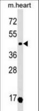 OXTR Antibody western blot of mouse heart tissue lysates (35 ug/lane). The OXTR antibody detected the OXTR protein (arrow).