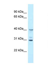 Oas1g antibody LS-C145862 Western blot of Mouse Liver lysate. Antibody concentration 1 ug/ml.
