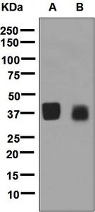 Western blot analysis on (A) human artery and (B) human skin lysates using anti-OGN antibody.