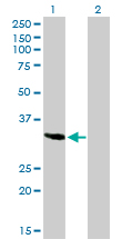 Western Blot analysis of SPARC expression in transfected 293T cell line by SPARC monoclonal antibody (M02), clone 1B2.Lane 1: SPARC transfected lysate(34.6 KDa).Lane 2: Non-transfected lysate.