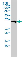 SPARC monoclonal antibody (M02), clone 1B2 Western Blot analysis of SPARC expression in A-431.