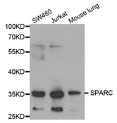 Western blot analysis of extracts of various cell lines, using SPARC antibody.