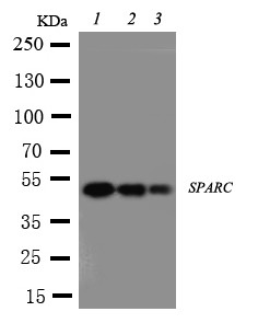 WB of Osteonectin / SPARC antibody. Lane 1: Recombinant Human SPARC Protein 10ng. Lane 2: Recombinant Human SPARC Protein 5ng. Lane 3: Recombinant Human SPARC Protein 2.5ng.