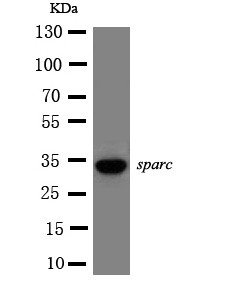 WB of Osteonectin / SPARC antibody. All lanes: Anti-SPARC at 0.5ug/ml. WB: HELA Whole Cell Lysate at 40ug. Predicted bind size: 35KD. Observed bind size: 35KD.