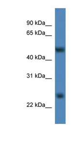 METTL4 antibody LS-C135218 Western blot of Rat Liver lysate.