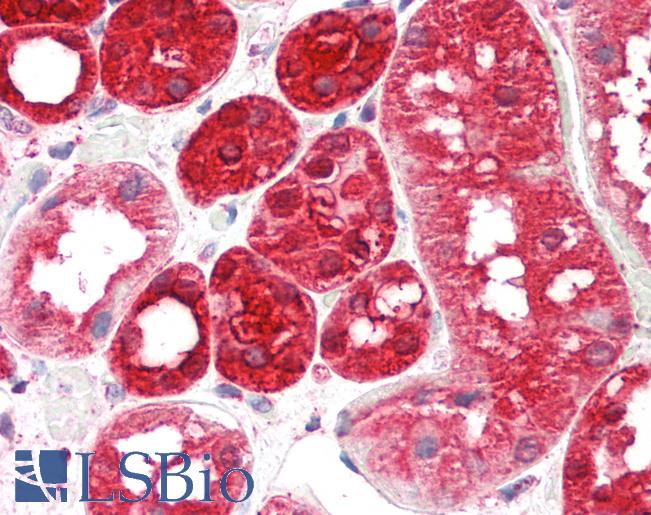 Human Kidney: Formalin-Fixed, Paraffin-Embedded (FFPE)