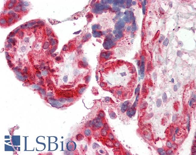 Human Placenta: Formalin-Fixed, Paraffin-Embedded (FFPE)