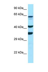 SPARC / Osteonectin antibody western blot of PANC1 cell lysate. Antibody concentration 1 ug/ml.