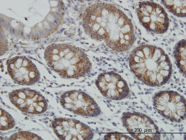 Immunoperoxidase of monoclonal antibody to MT on formalin-fixed paraffin-embedded human colon. [antibody concentration 3 ug/ml]