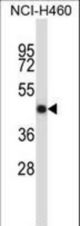 TNFRSF11B Antibody western blot of NCI-H460 cell line lysates (35 ug/lane). The TNFRSF11B antibody detected the TNFRSF11B protein (arrow).