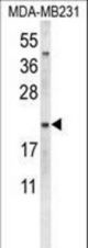 Western blot of NEU1 Antibody in MDA-MB231 cell line lysates (35 ug/lane). NEU1 (arrow) was detected using the purified antibody.