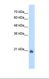 Transfected 293T cell lysate. Antibody concentration: 2.5 ug/ml. Gel concentration: 12%.