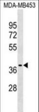 P2RX3 Antibody western blot of MDA-MB453 cell line lysates (35 ug/lane). The P2RX3 antibody detected the P2RX3 protein (arrow).