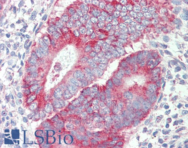 Anti-P2RX4 / P2X4 antibody IHC staining of human uterus. Immunohistochemistry of formalin-fixed, paraffin-embedded tissue after heat-induced antigen retrieval. Antibody LS-B9556 concentration 5 ug/ml.