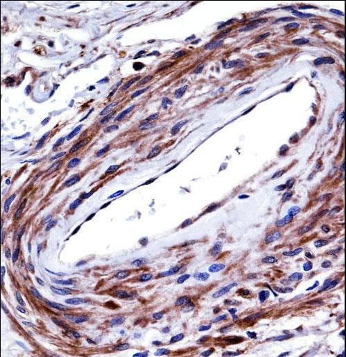 P2RX5 Antibody immunohistochemistry of formalin-fixed and paraffin-embedded human cervix tissue followed by peroxidase-conjugated secondary antibody and DAB staining.