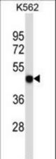 P2RX5 Antibody western blot of K562 cell line lysates (35 ug/lane). The P2RX5 antibody detected the P2RX5 protein (arrow).